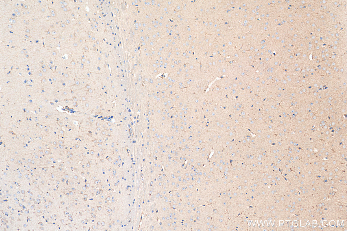 IHC staining of mouse brain using 80517-1-RR (same clone as 80517-1-PBS)