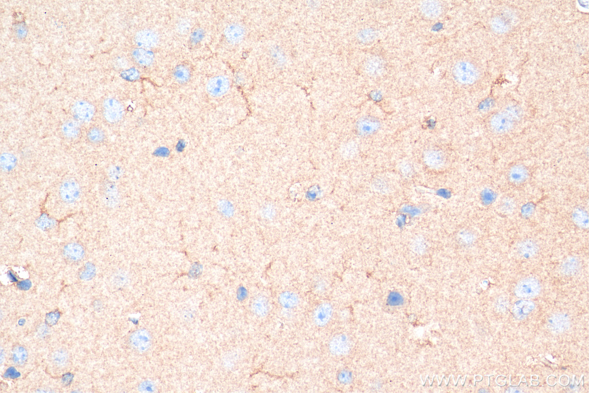 IHC staining of mouse brain using 80517-1-RR (same clone as 80517-1-PBS)