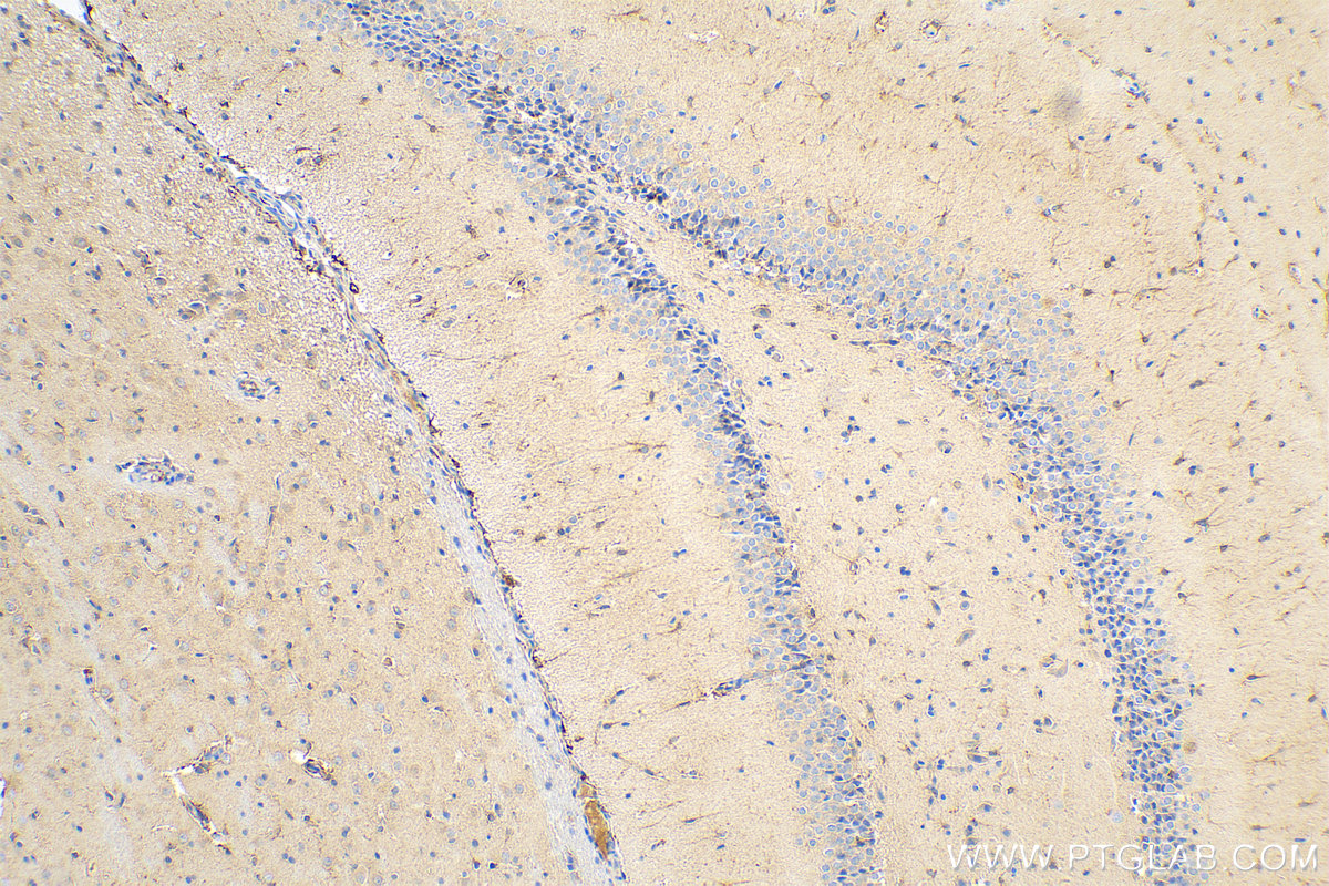 IHC staining of rat brain using 80517-1-RR (same clone as 80517-1-PBS)