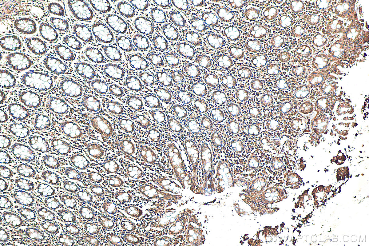 IHC staining of human colon using 80517-1-RR (same clone as 80517-1-PBS)