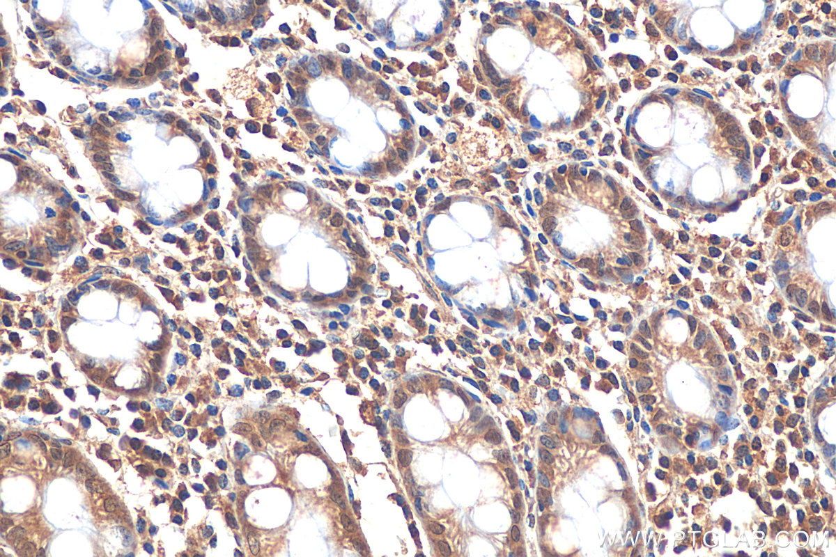 IHC staining of human colon using 80517-1-RR (same clone as 80517-1-PBS)