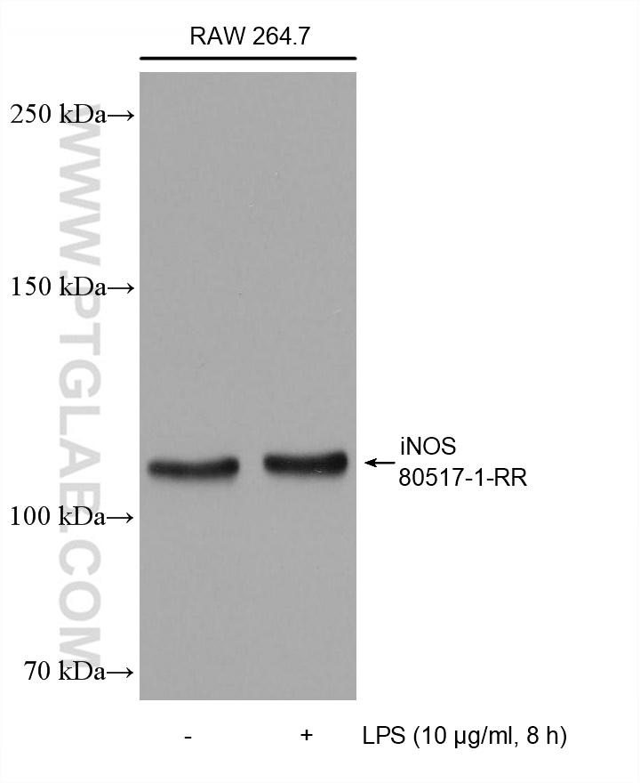 WB analysis using 80517-1-RR (same clone as 80517-1-PBS)