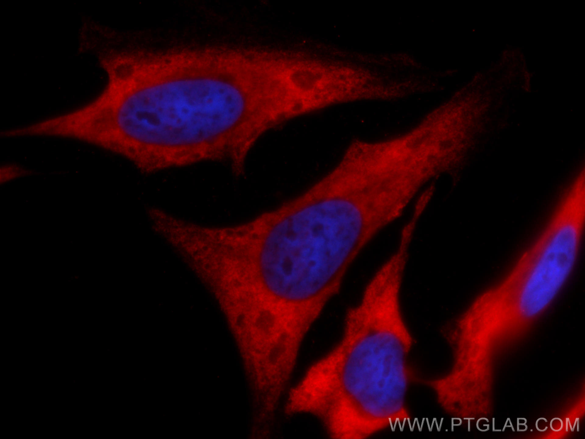 IF Staining of HeLa using CL594-18985
