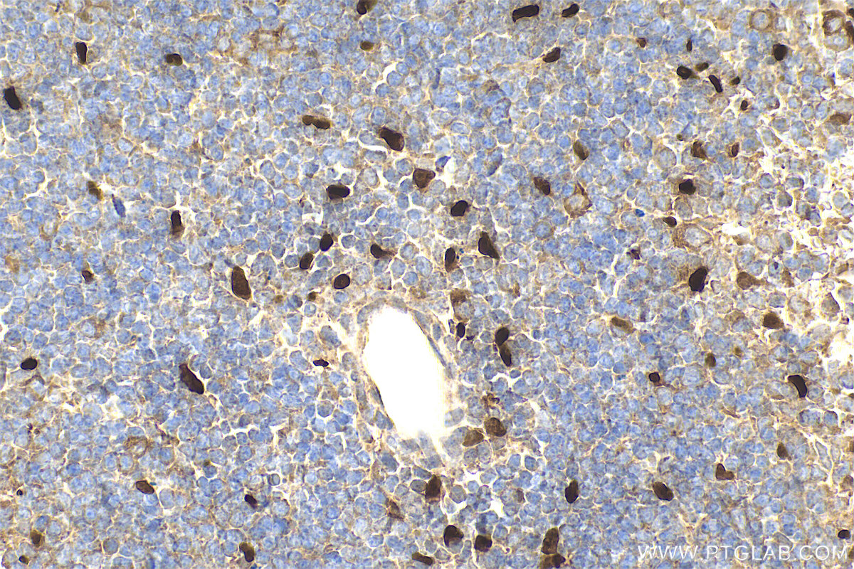 Immunohistochemical analysis of paraffin-embedded mouse spleen tissue slide using 28035-1-AP (IL-33 antibody) at dilution of 1:400 (under 40x lens). Heat mediated antigen retrieval with Tris-EDTA buffer (pH 9.0). IHC staining of mouse spleen using 28035-1-AP