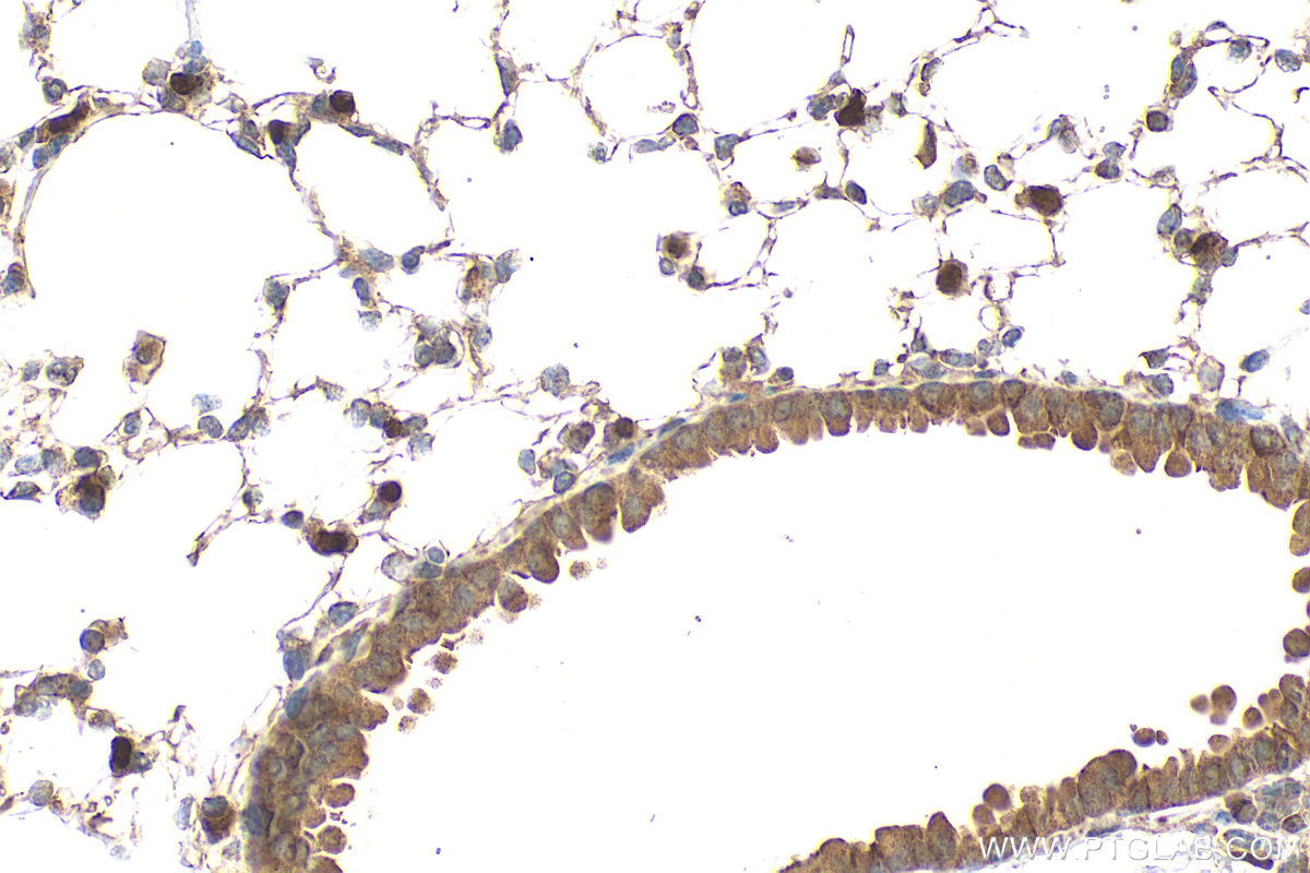 Immunohistochemical analysis of paraffin-embedded mouse lung tissue slide using 28035-1-AP (IL-33 antibody) at dilution of 1:400 (under 40x lens). Heat mediated antigen retrieval with Tris-EDTA buffer (pH 9.0). IHC staining of mouse lung using 28035-1-AP