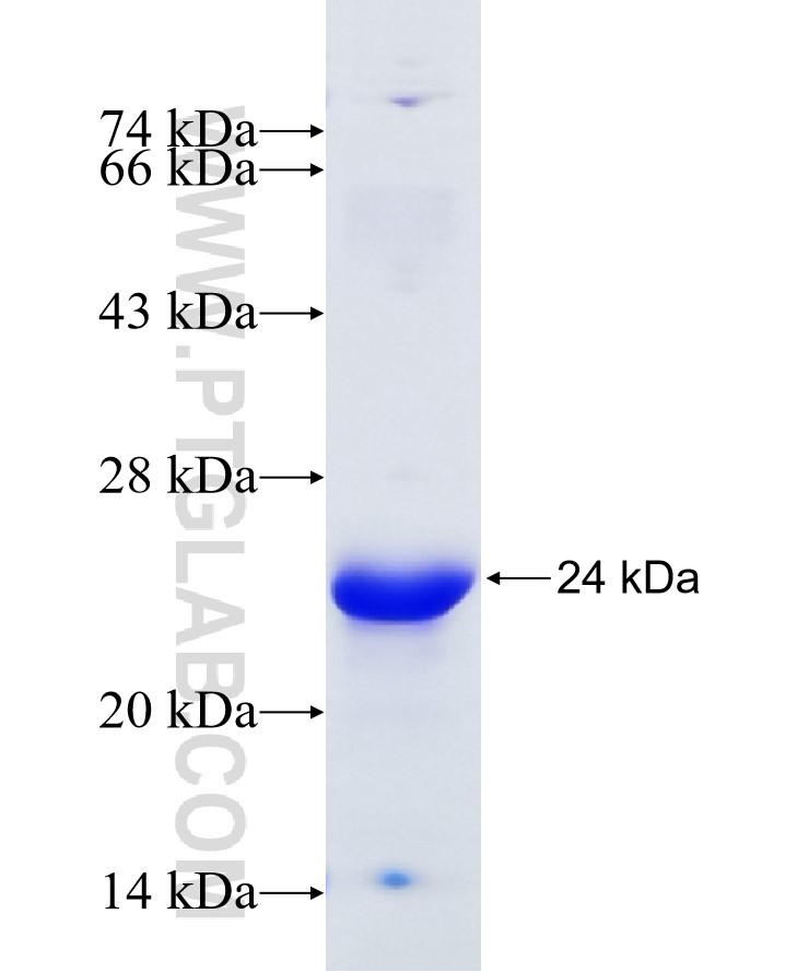 IL-33 fusion protein Ag27868 SDS-PAGE IL-33 fusion protein Ag27868 SDS-PAGE