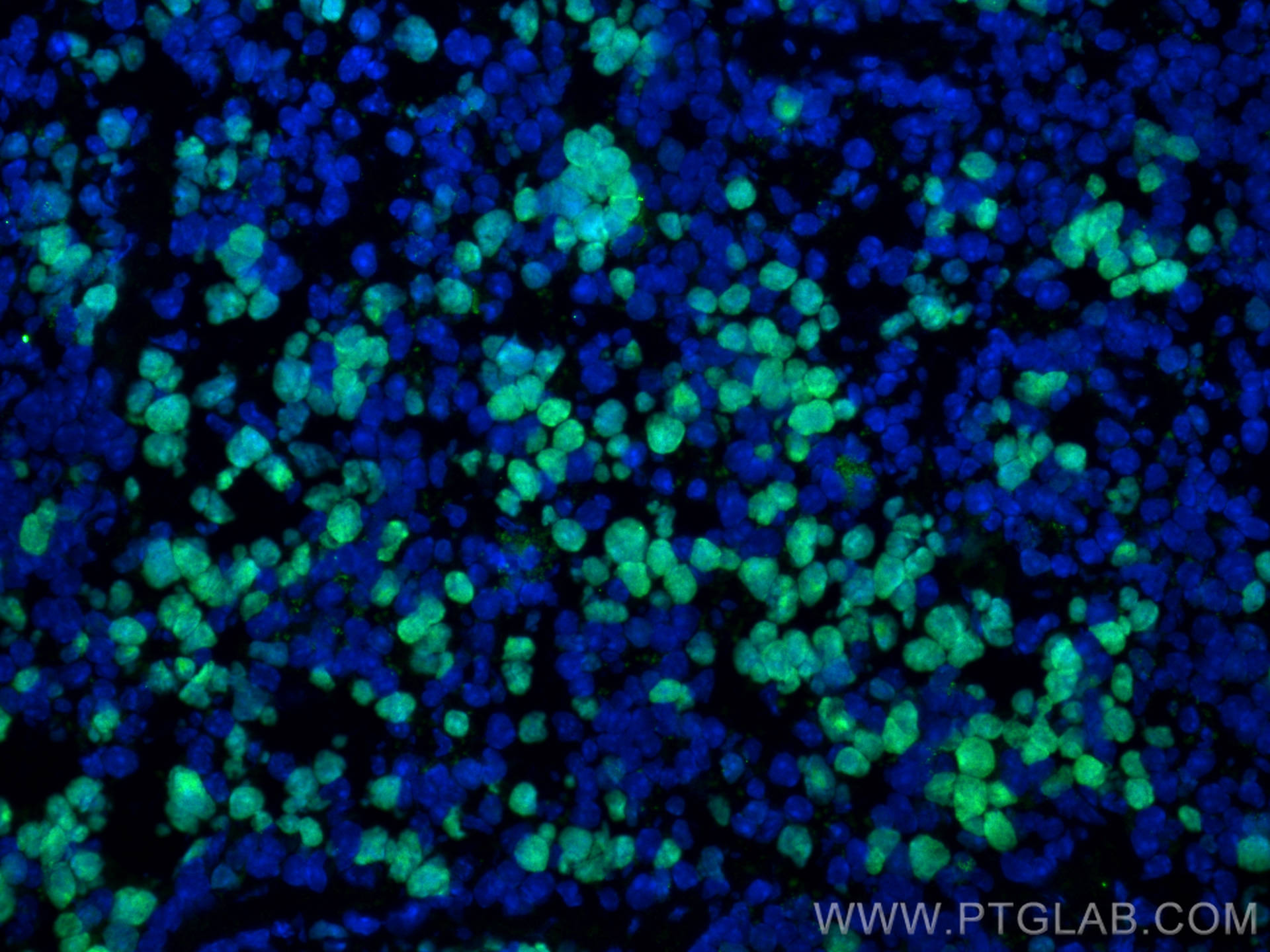 IF Staining of mouse spleen using 28074-1-AP