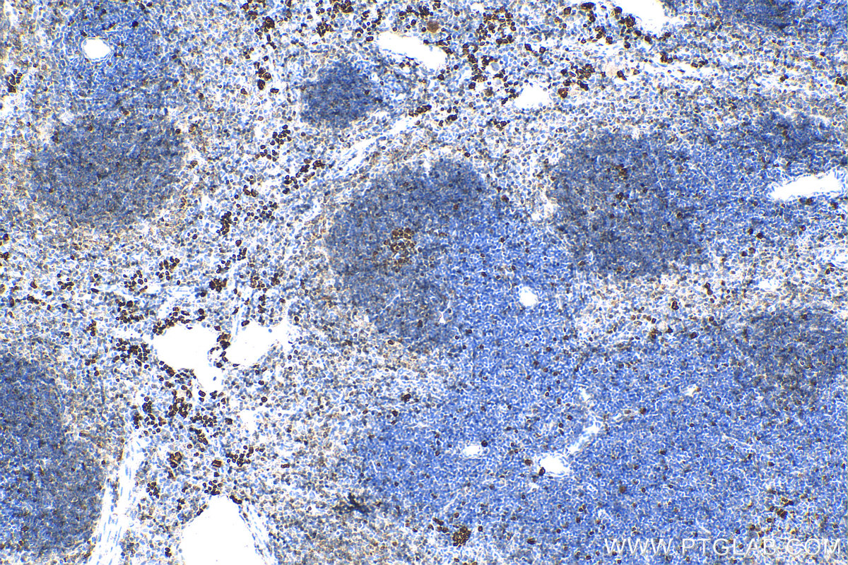 IHC staining of mouse spleen using 28074-1-AP