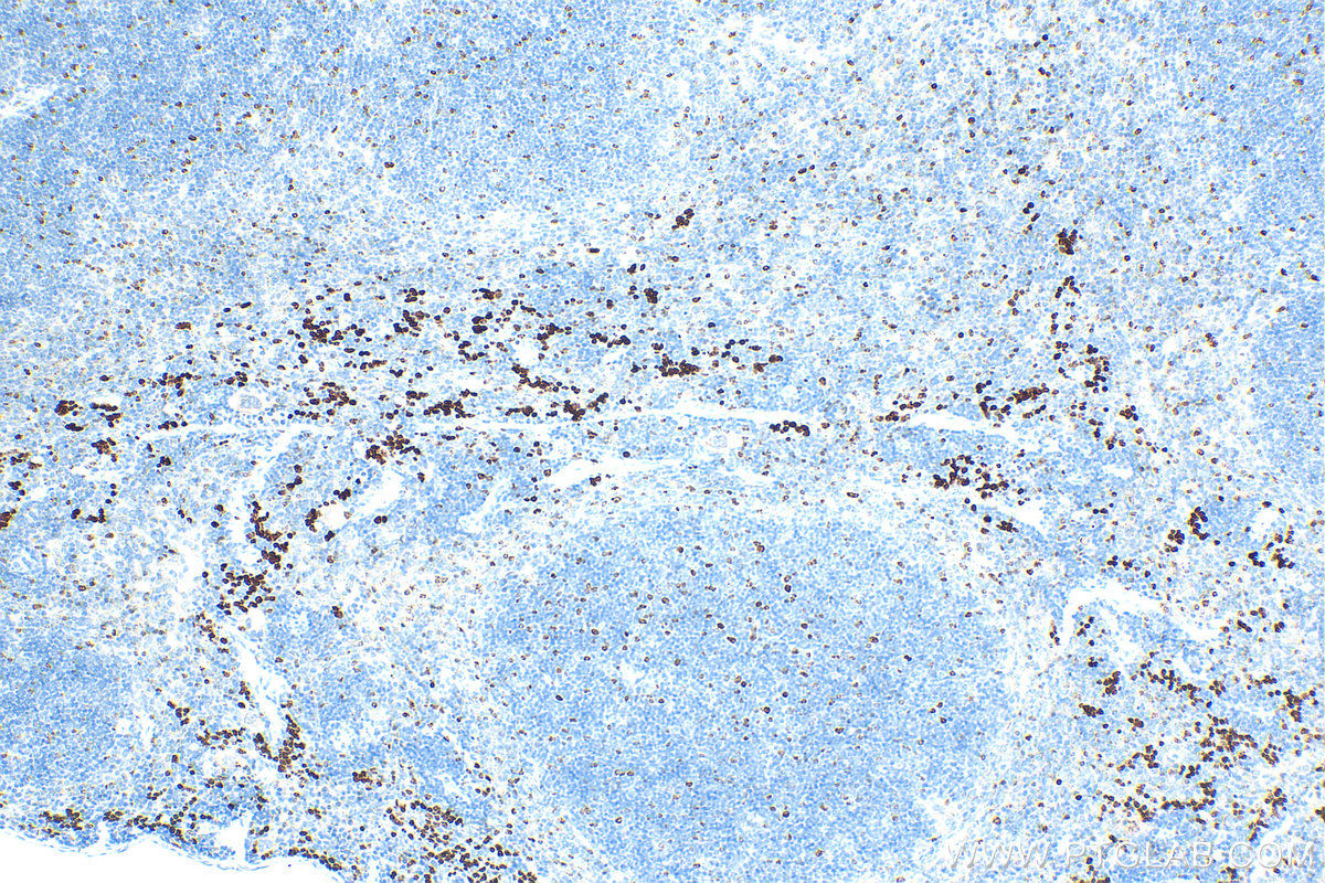 IHC staining of mouse spleen using 28074-1-AP IHC staining of mouse spleen using 28074-1-AP