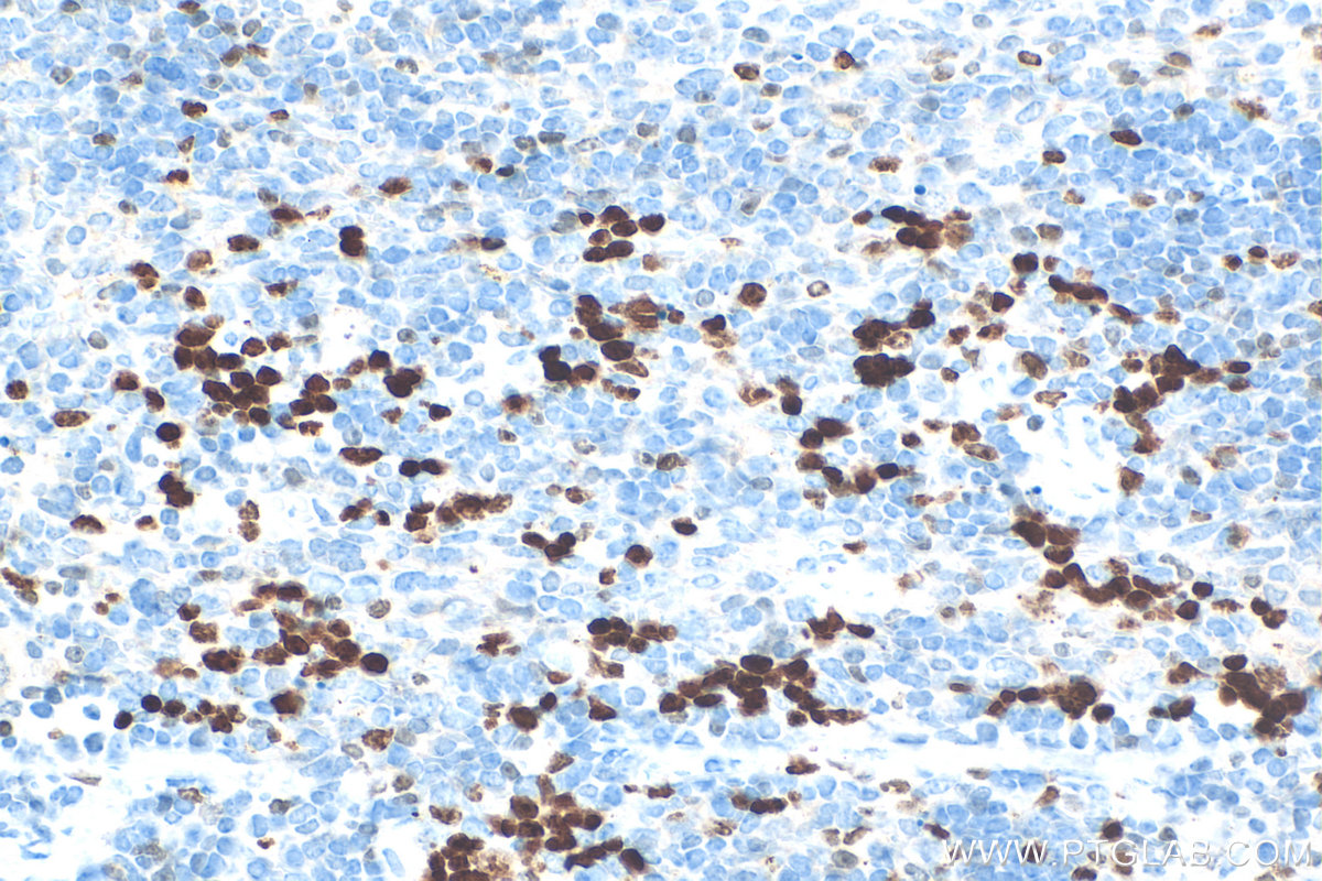IHC staining of mouse spleen using 28074-1-AP IHC staining of mouse spleen using 28074-1-AP