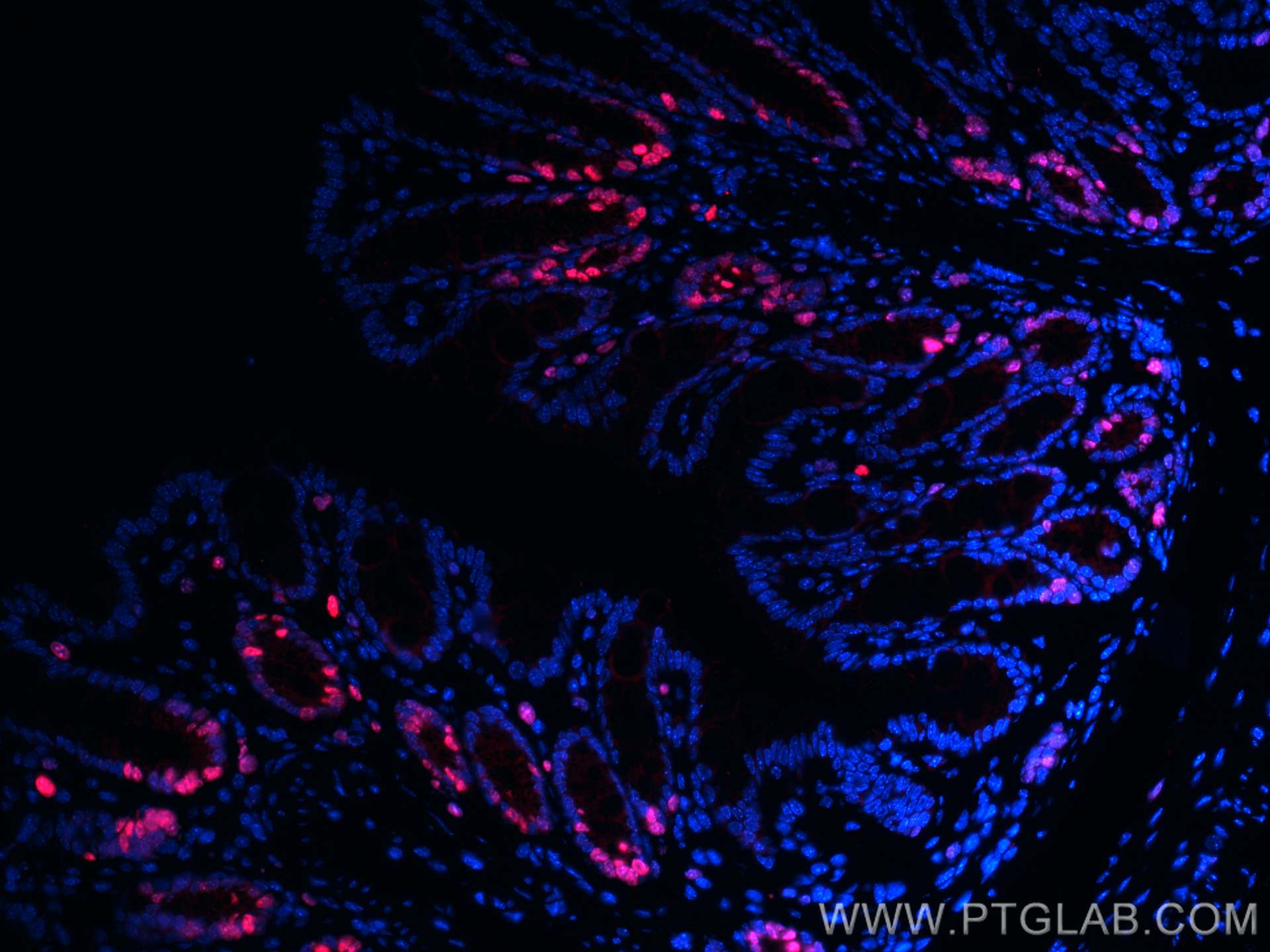 IF Staining of mouse colon using CL594-28074