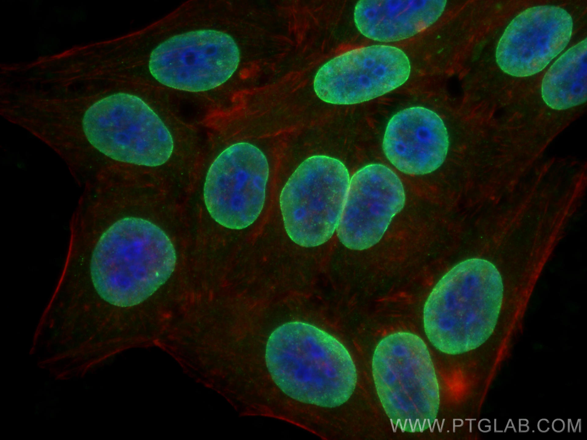 IF Staining of HepG2 using 10298-1-AP