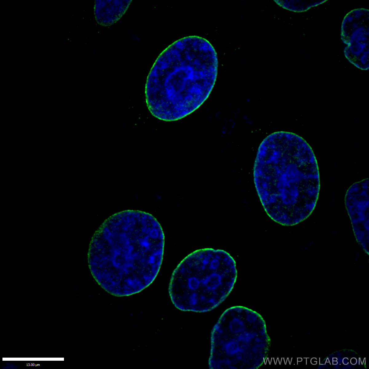 IF Staining of HepG2 using 10298-1-AP