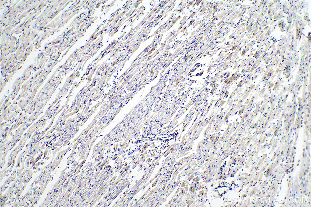 IHC staining of mouse heart using 10298-1-AP