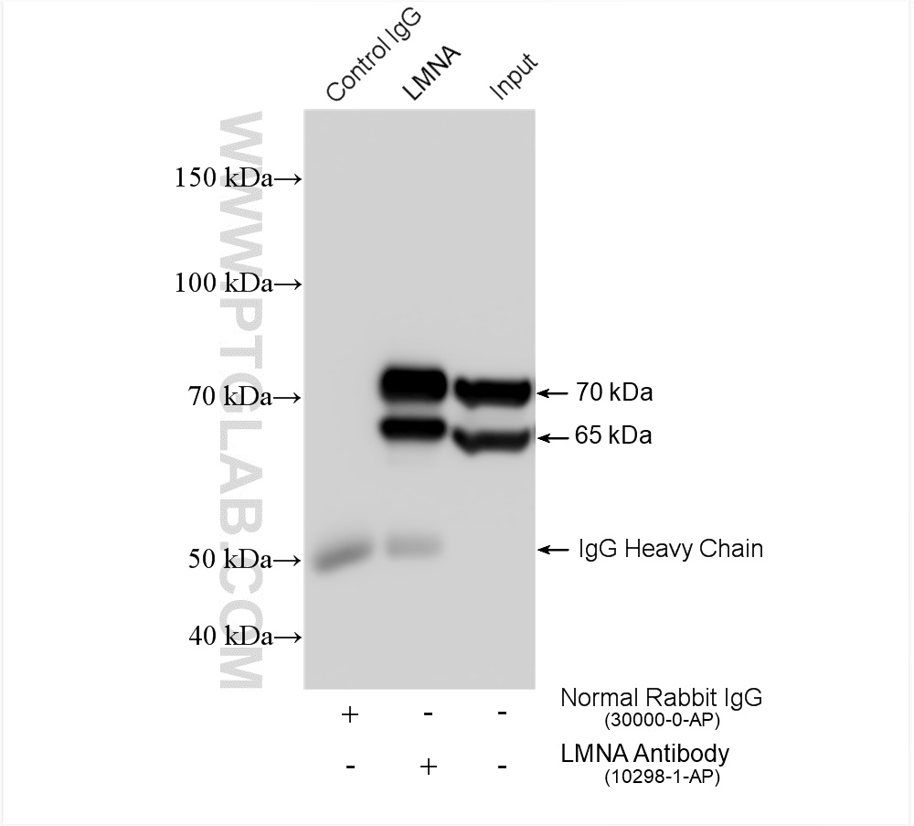 IP experiment of HeLa using 10298-1-AP