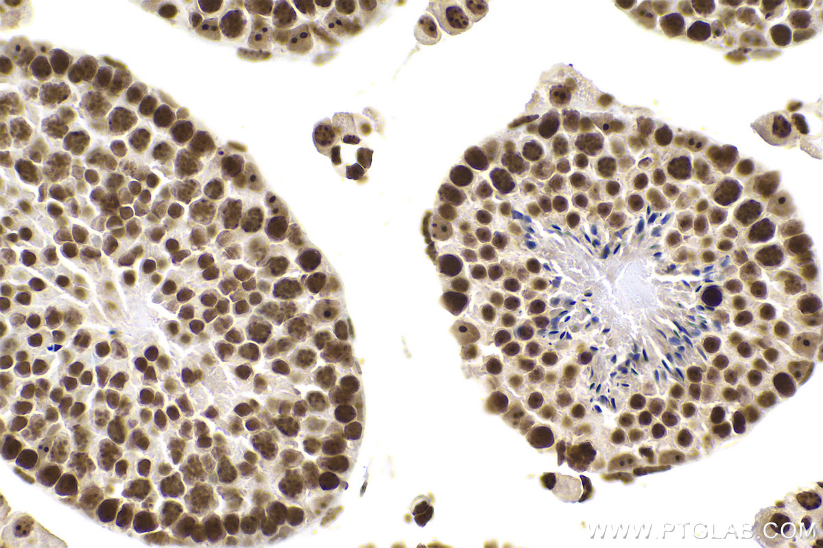 IHC staining of mouse testis using 68301-1-Ig (same clone as 68301-1-PBS)