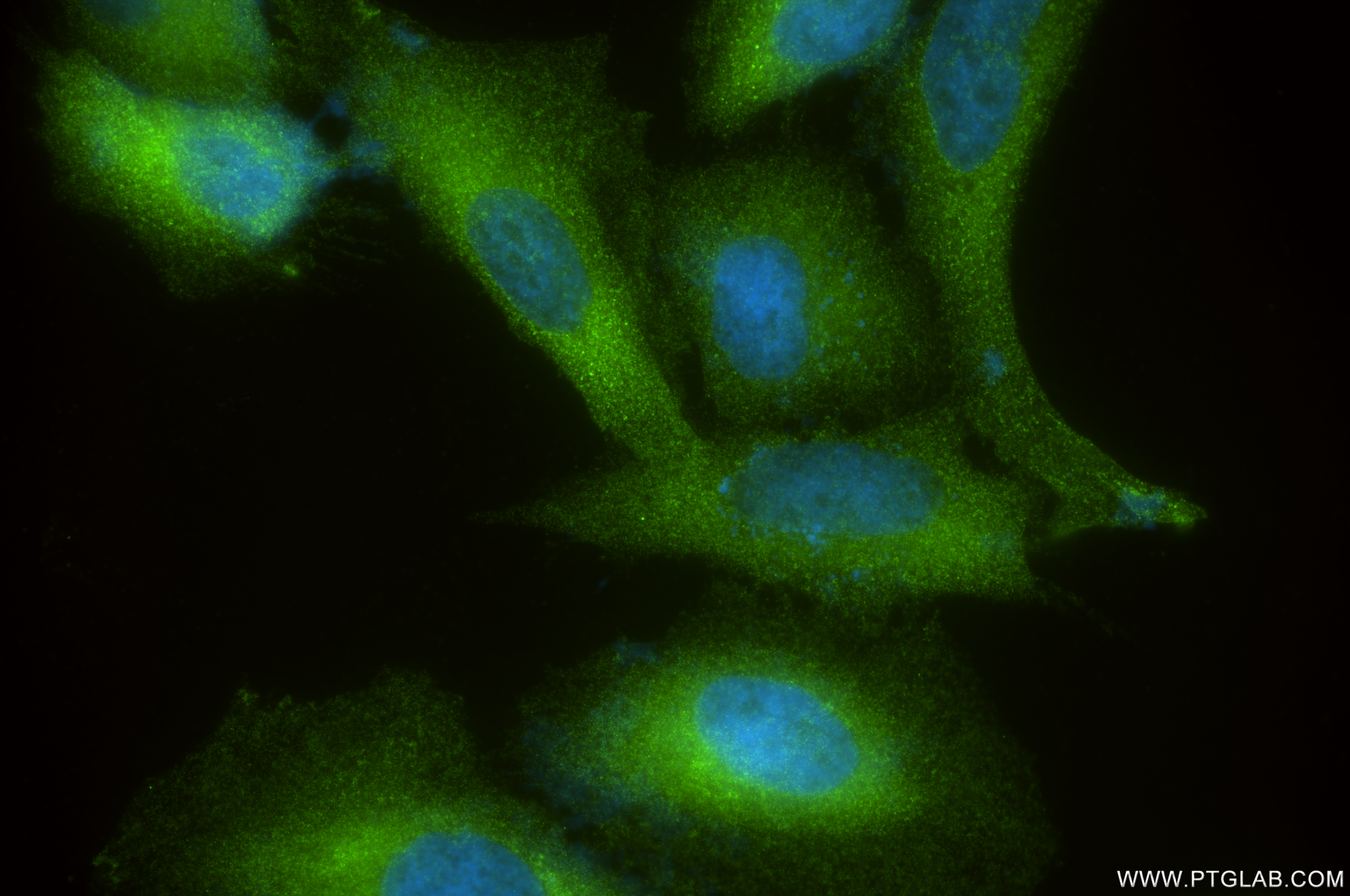 IF Staining of HeLa using 85708-2-RR (same clone as 85708-2-PBS)