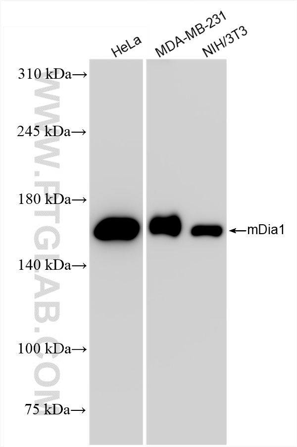 WB analysis using 85708-2-RR (same clone as 85708-2-PBS)