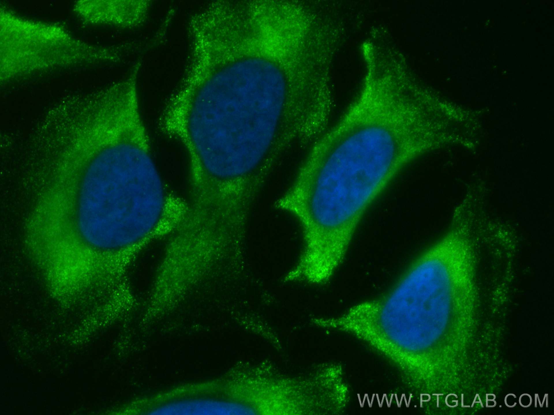 IF Staining of HeLa using CL488-20624