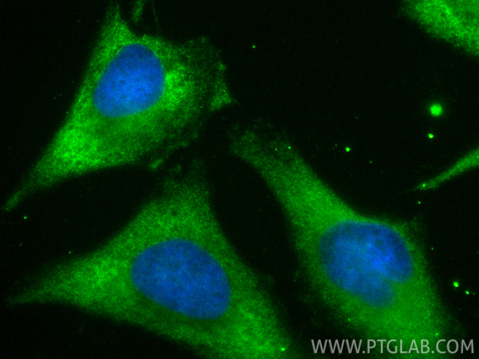 Immunofluorescent analysis of (-20°C Ethanol) fixed HeLa cells using CoraLite® Plus 488 mDia1 antibody (CL488-85708-2, Clone: 243001A5 ) at dilution of 1:200. IF Staining of HeLa using CL488-85708-2