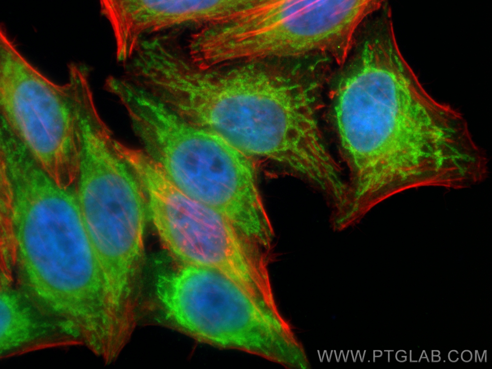 IF Staining of HepG2 using 16006-1-AP
