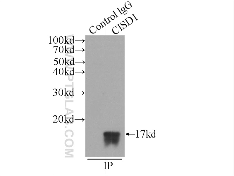 IP experiment of HepG2 using 16006-1-AP