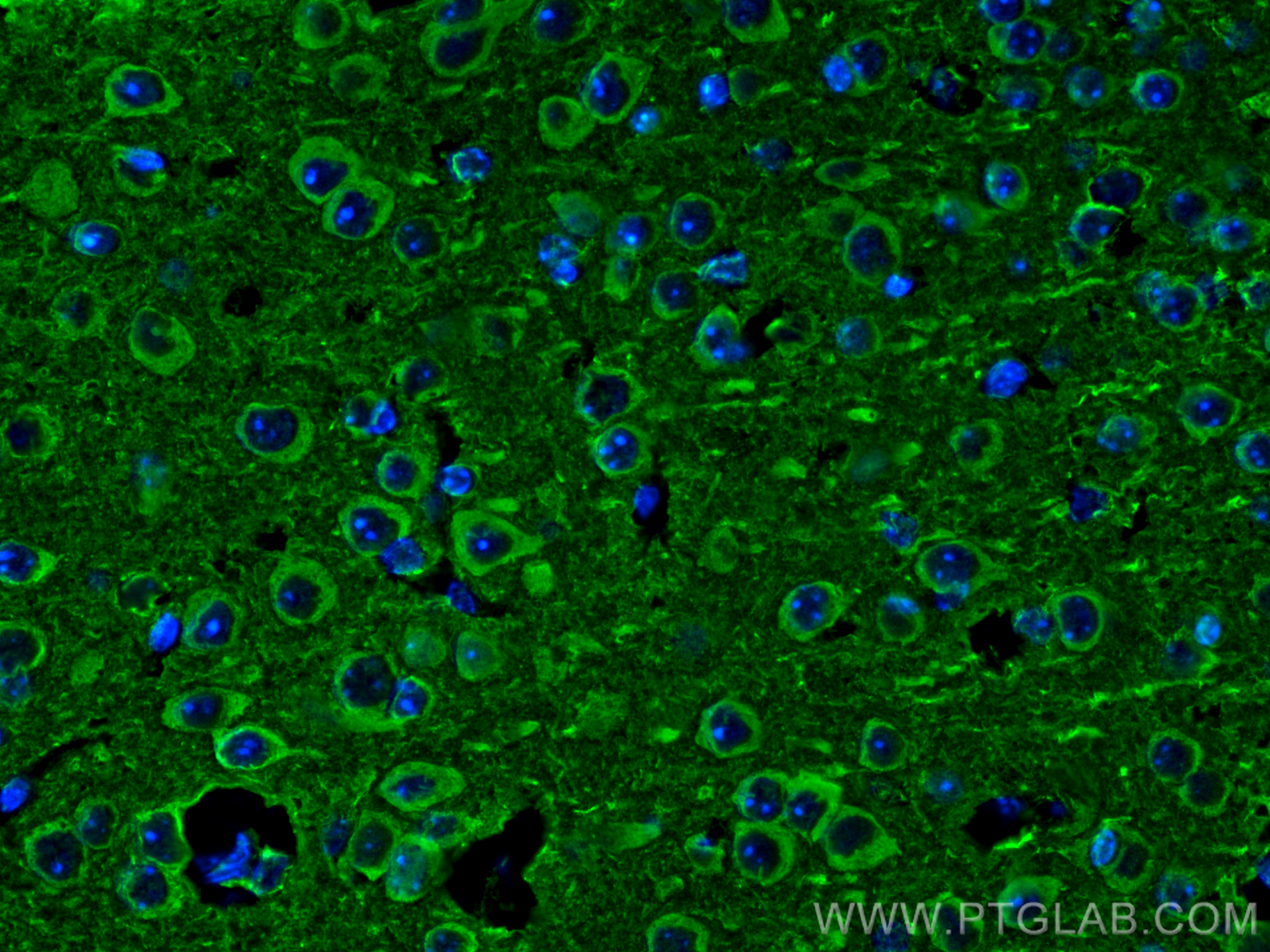IF Staining of mouse brain using 18984-1-AP