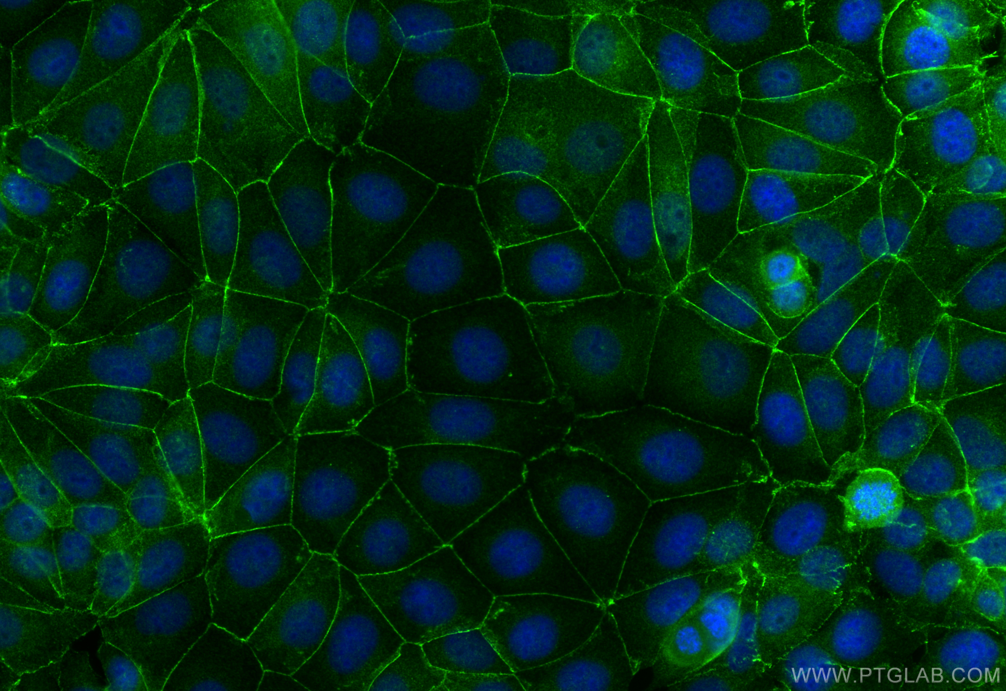 IF Staining of MCF-7 using 21903-1-AP