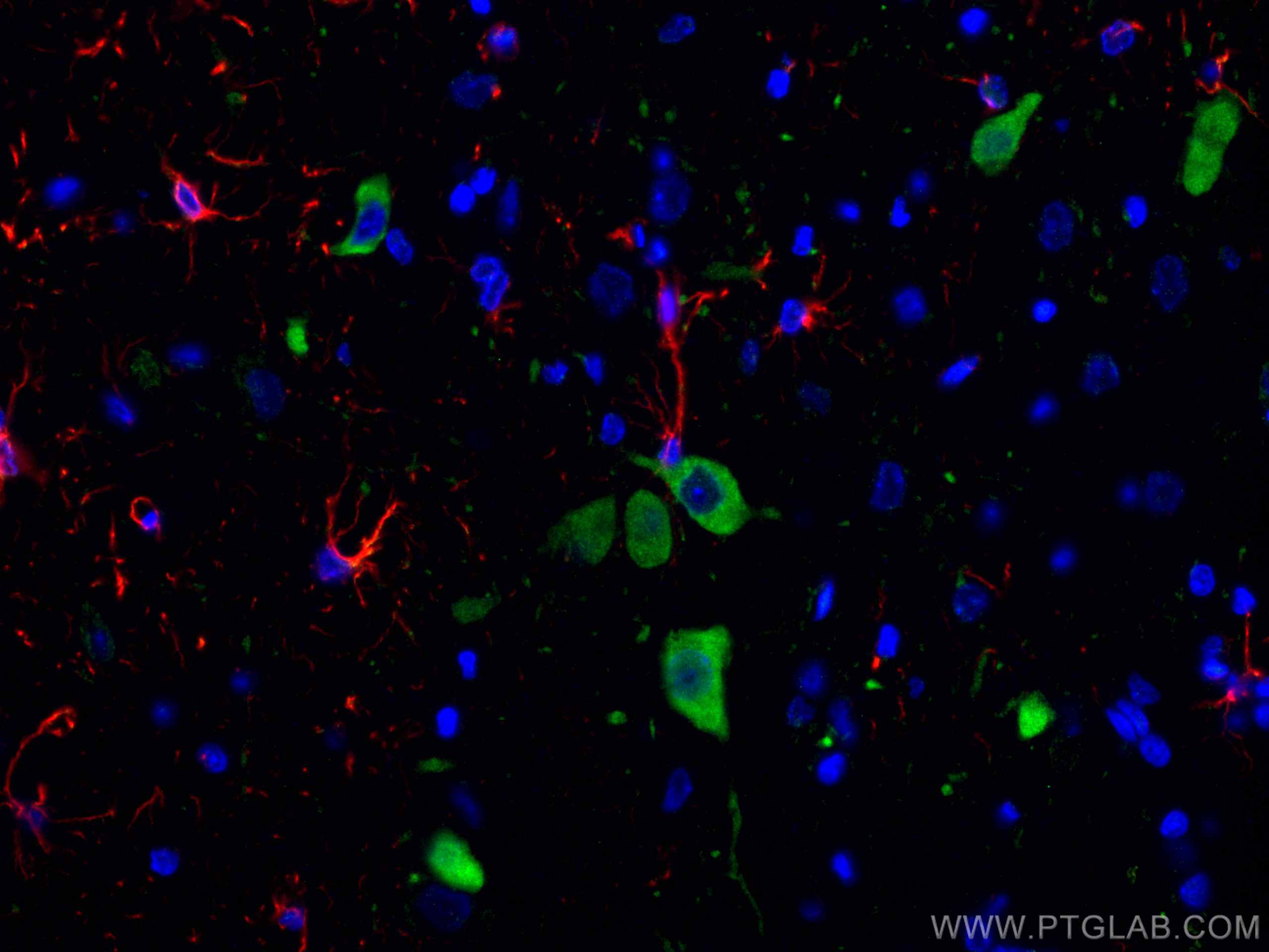 IF Staining of rat brain using 29285-1-AP