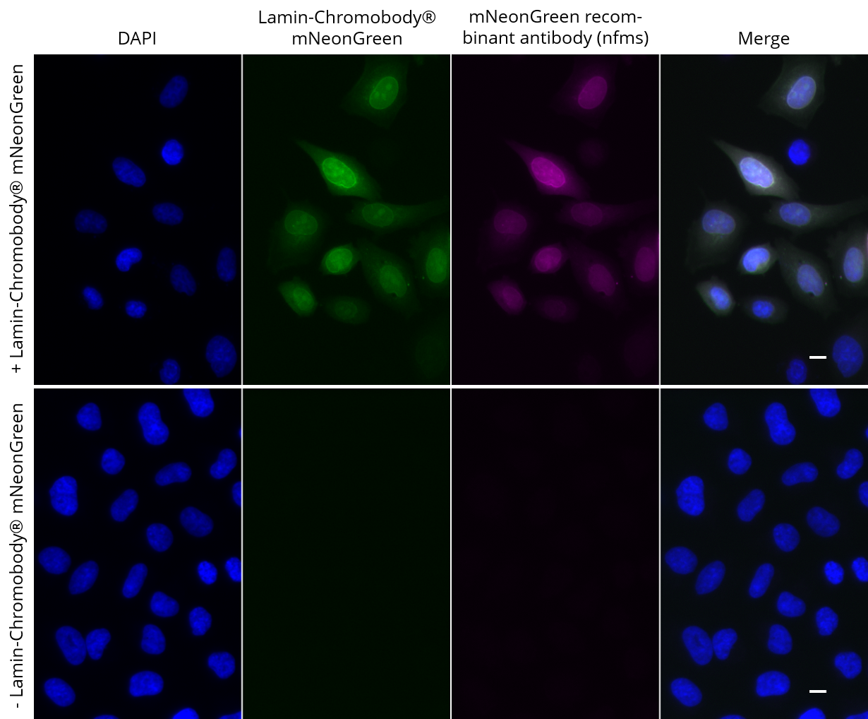 HeLa cells transiently expressing Lamin-Chromobody?-mNeonGreen were immunostained with mNeonGreen recombinant antibody, VHH-mouse IgG1 Fc fusion [CTK0203] (nfms-20, 1:500) and Nano-Secondary? alpaca anti-mouse IgG1, recombinant VHH, Alexa Fluor? 647 [CTK0103, CTK0104] (sms1AF647-1, 1:500). Scale bar, 10 μM