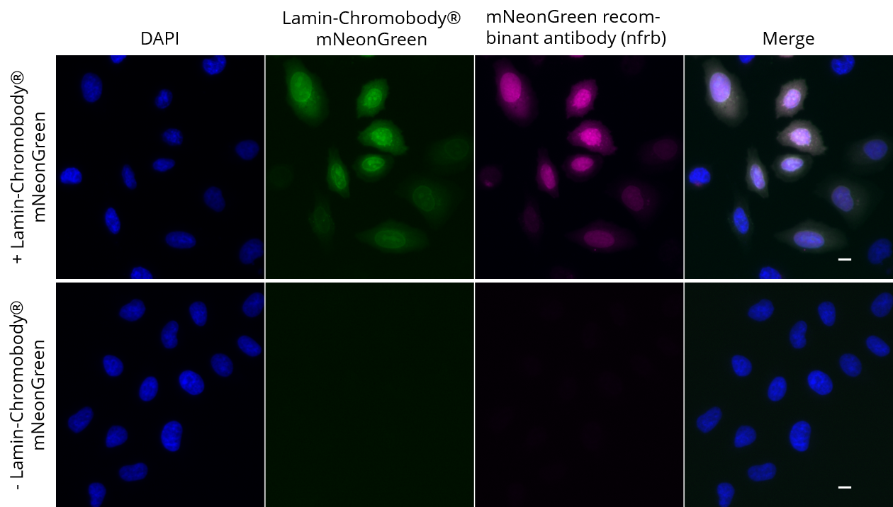 HeLa cells transiently expressing Lamin-Chromobody?-mNeonGreen were immunostained with mNeonGreen recombinant antibody, VHH-rabbit IgG Fc fusion [CTK0203] (nfrb, 1:1,000) and Nano-Secondary? alpaca anti-human IgG/anti-rabbit IgG, recombinant VHH, Alexa Fluor? 647 [CTK0101, CTK0102] (srbAF647-1, 1:1,000). Scale bar, 10 μM.