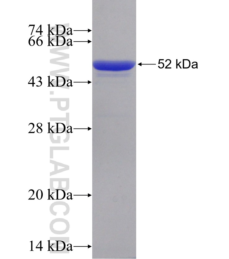 2019-nCOV nucleocapsid phosphoprotein fusion protein Ag30676 SDS-PAGE