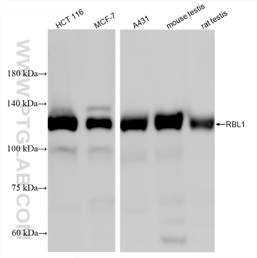 WB analysis using 87119-3-RR (same clone as 87119-3-PBS)