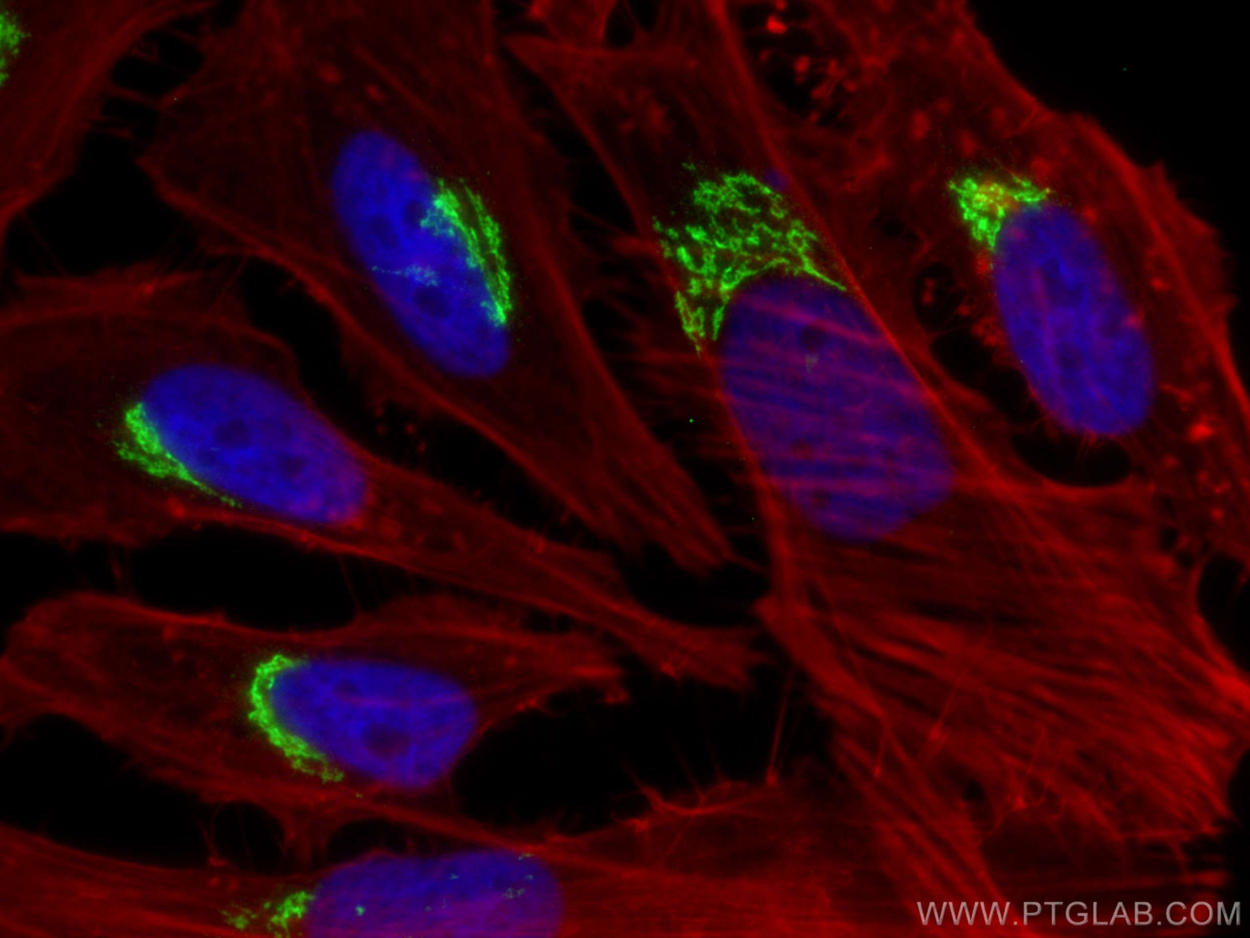 IF Staining of HeLa using 68100-1-Ig