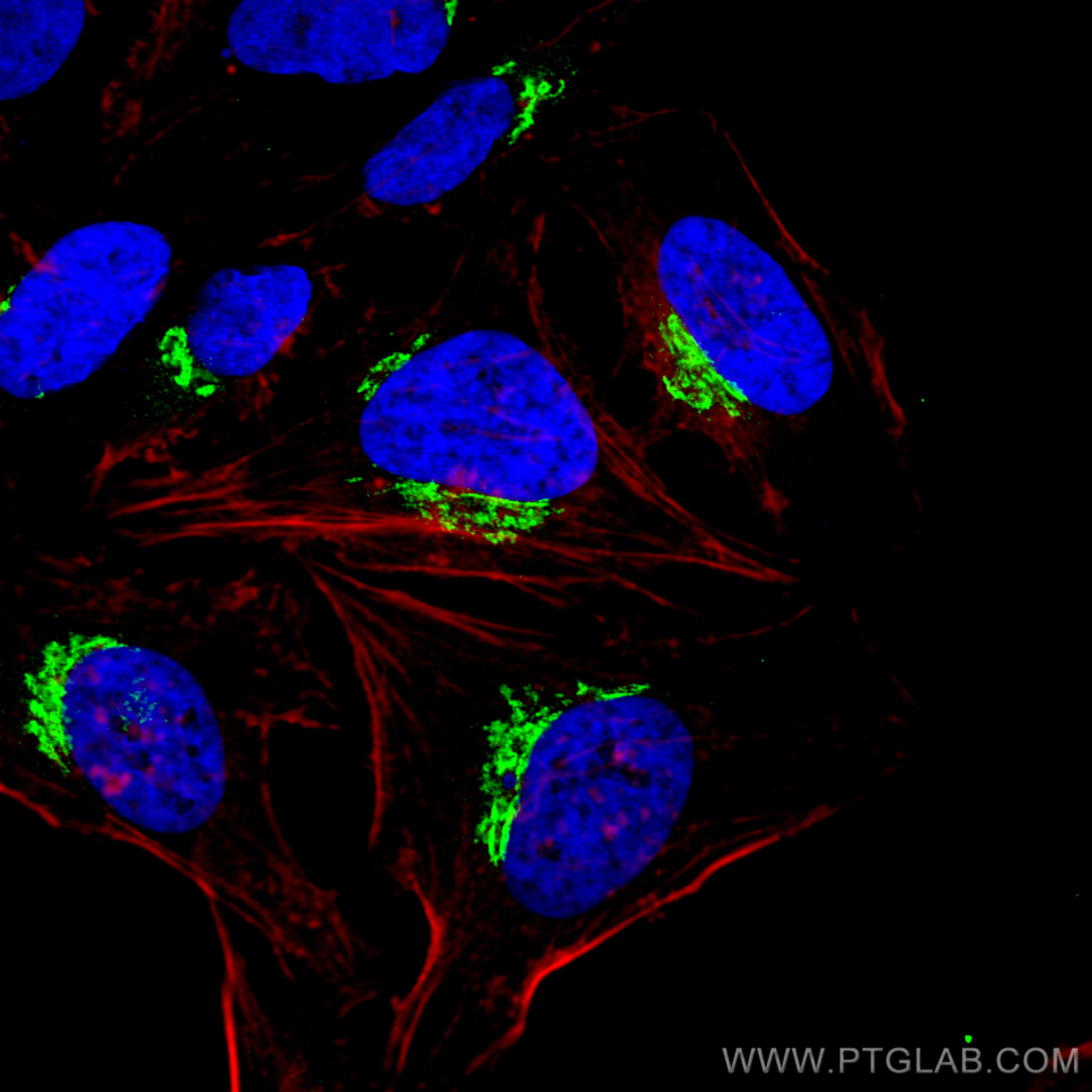 IF Staining of HeLa using 68100-1-Ig (same clone as 68100-1-PBS)