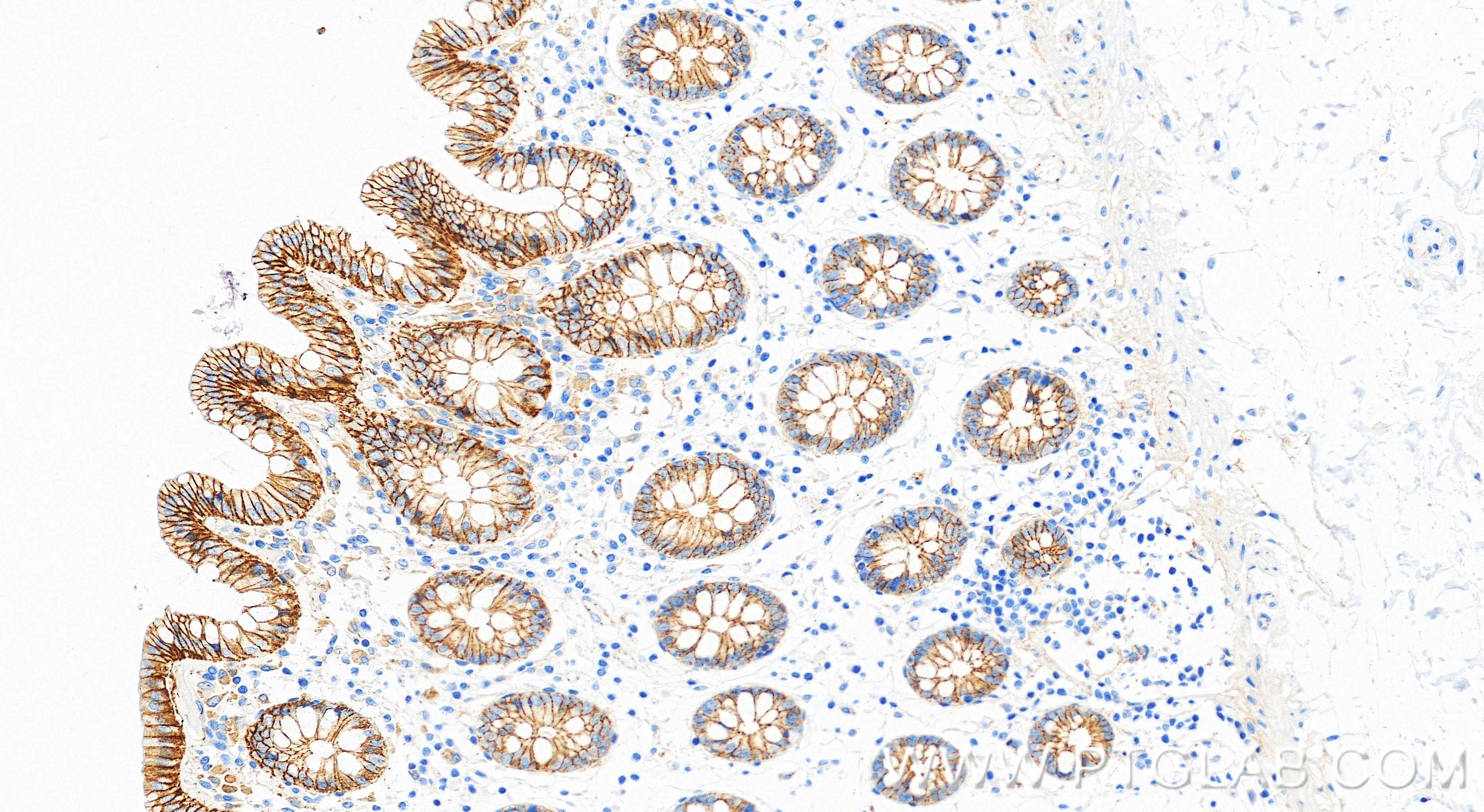 IHC staining of human colon using 88083-1-RR