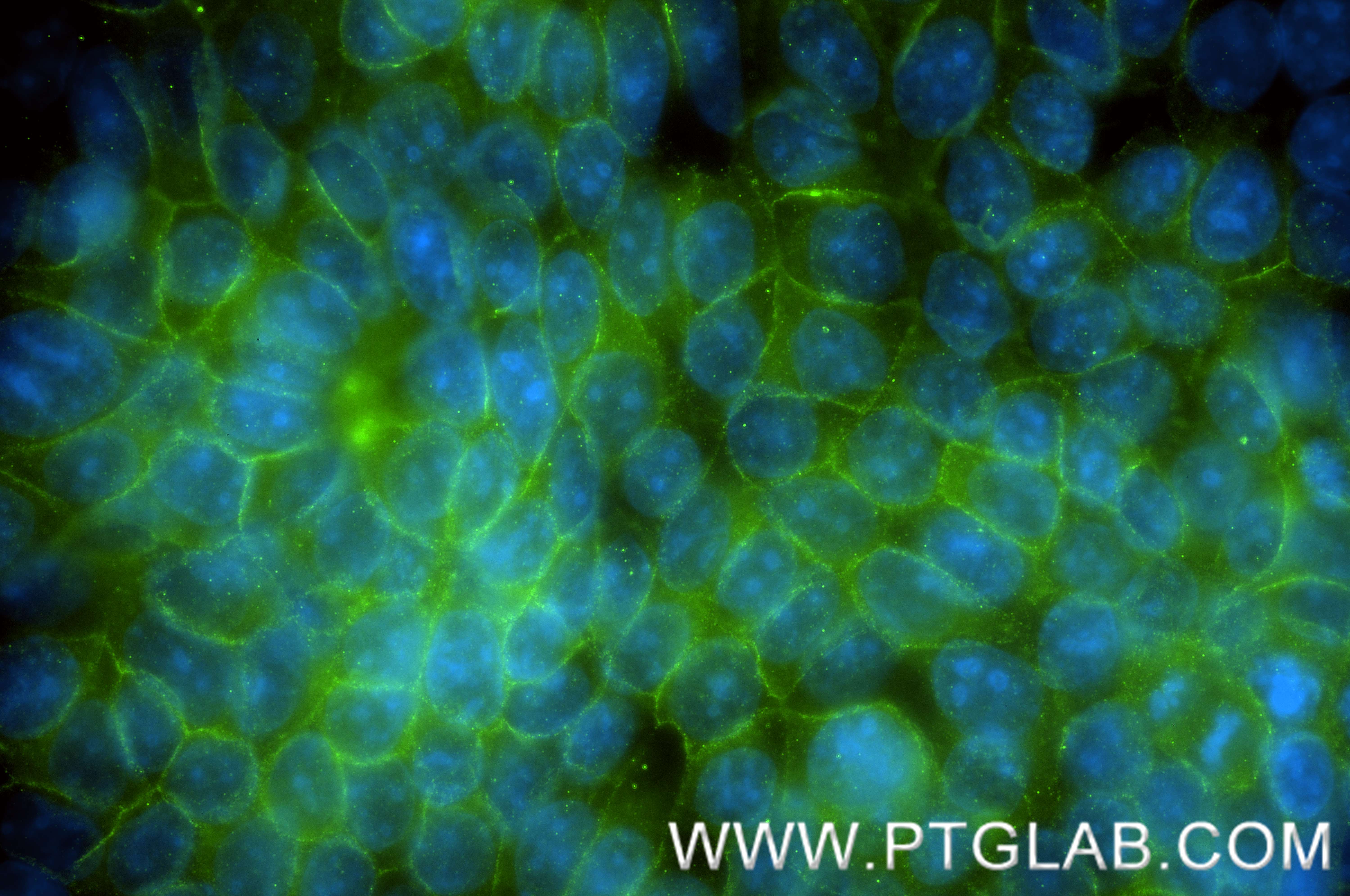 IF Staining of MCF-7 using 88083-1-RR (same clone as 88083-1-PBS) IF Staining of MCF-7 using 88083-1-RR (same clone as 88083-1-PBS)