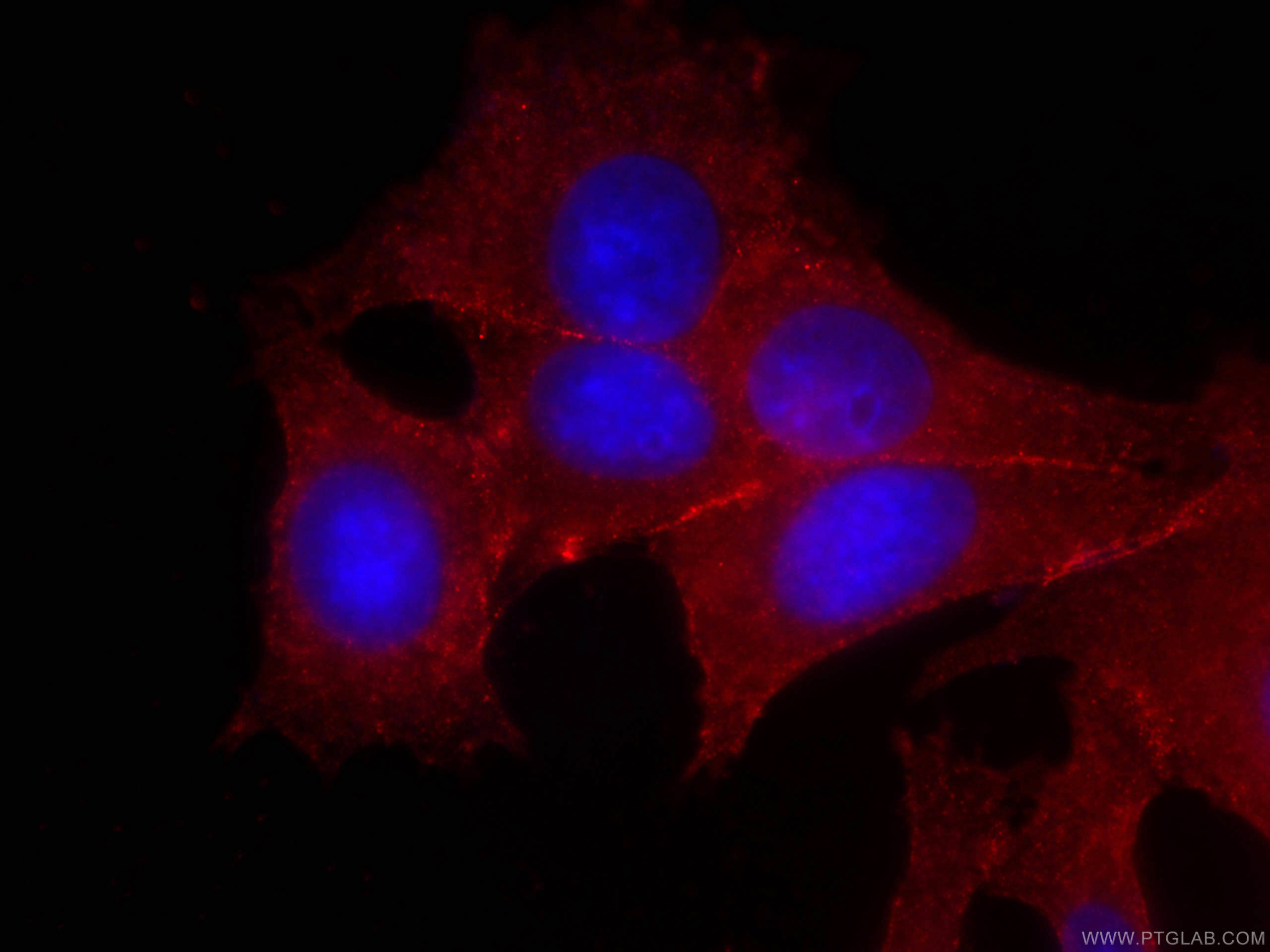 IF Staining of MCF-7 using CL594-66208