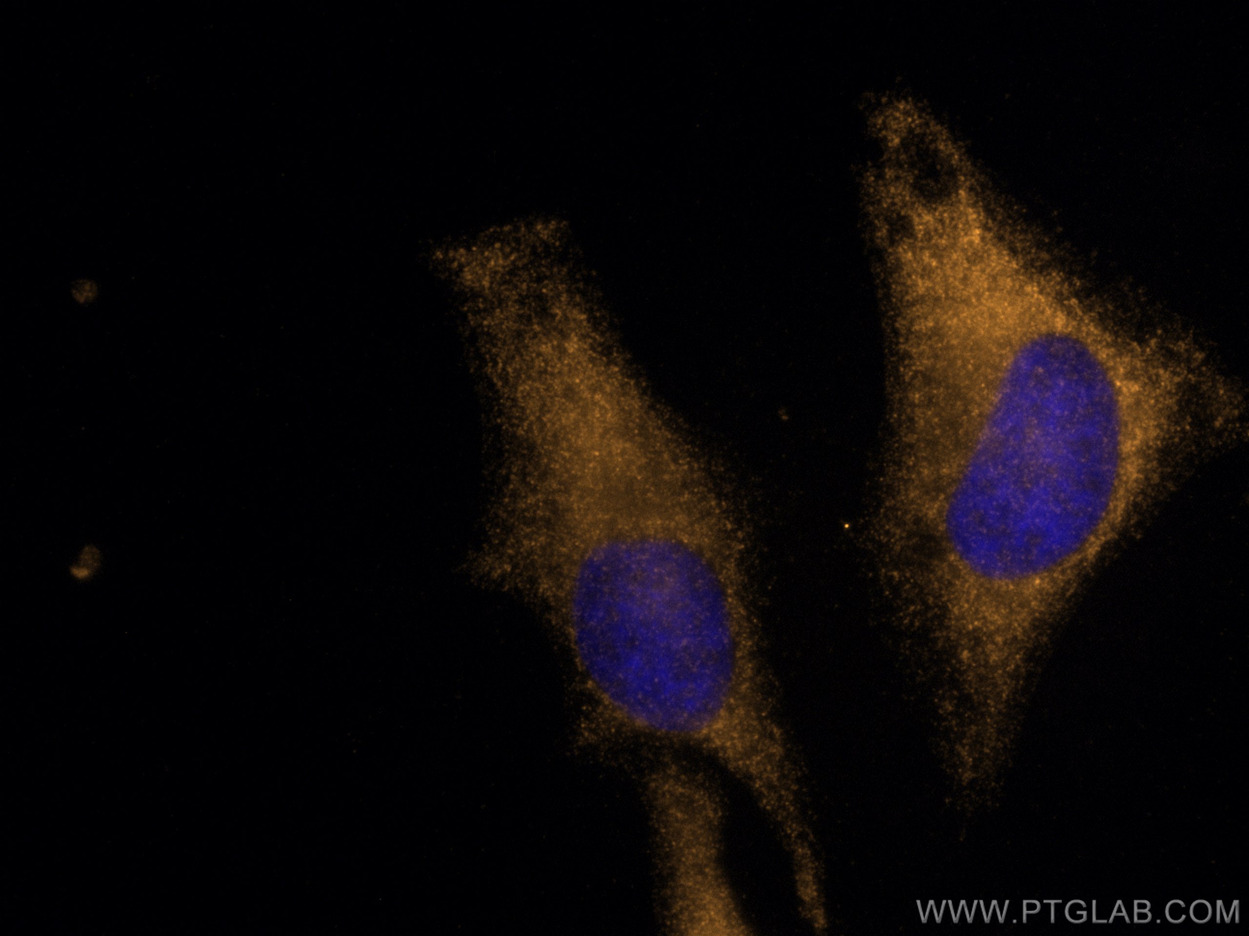 IF Staining of HeLa using CL555-16815