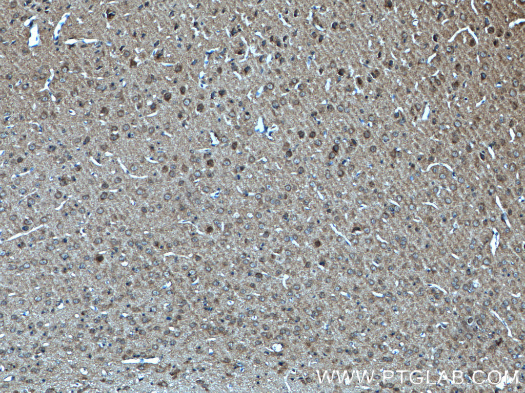 IHC staining of mouse brain using 55362-1-AP
