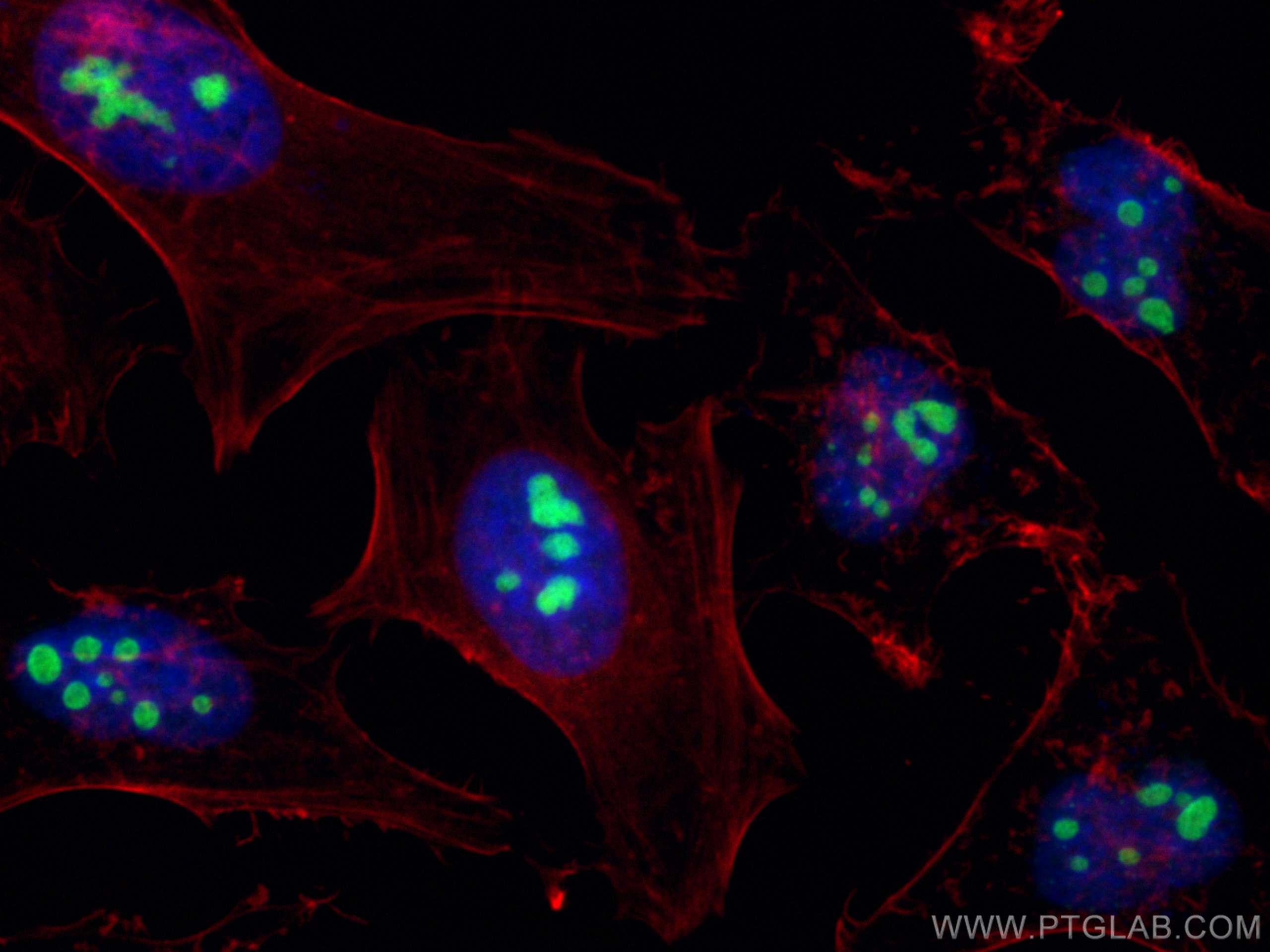 IF Staining of HeLa using 31221-1-AP
