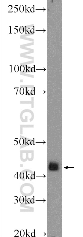 p38 MAPK Polyclonal antibody