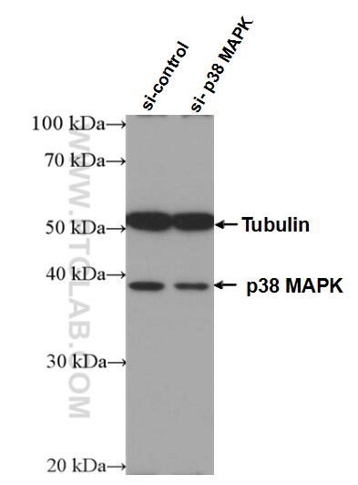 WB analysis of HEK-293 using 66234-1-Ig