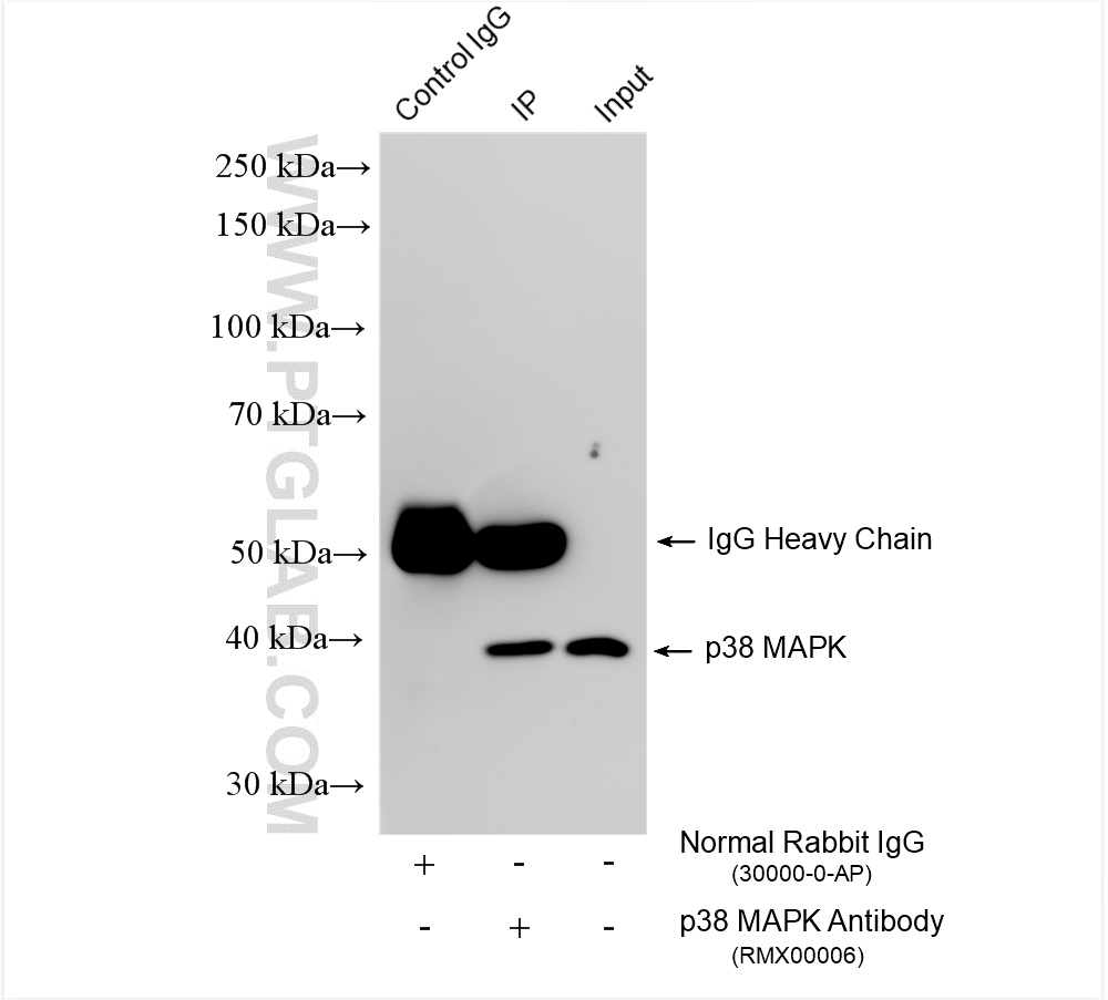 IP experiment of HEK-293 using RMX00006