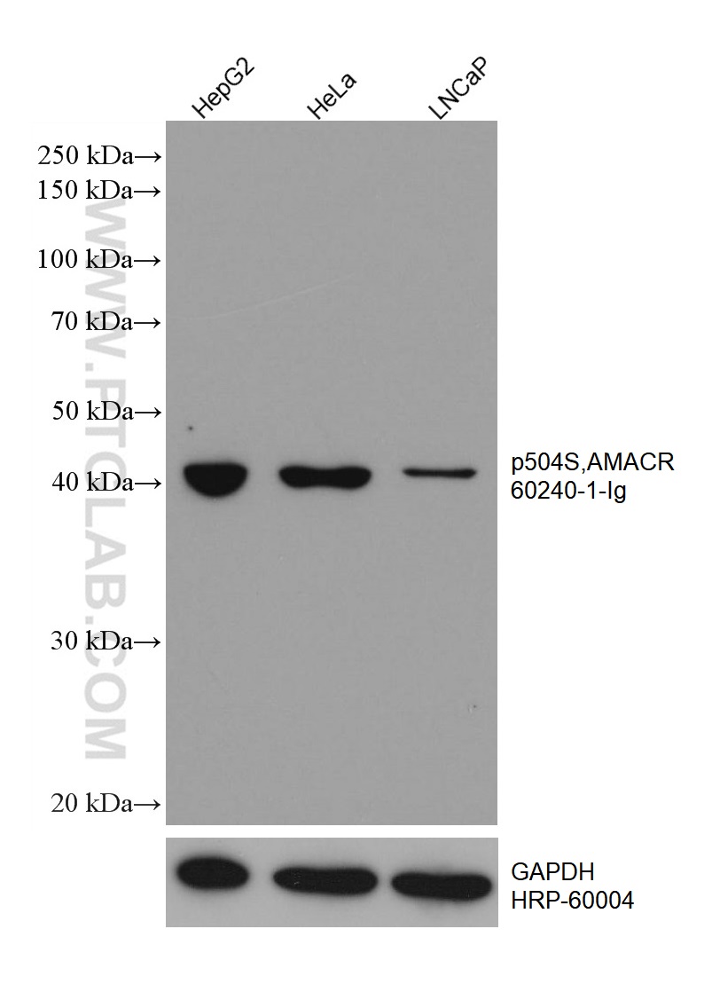 WB analysis using 60240-1-Ig (same clone as 60240-1-PBS)