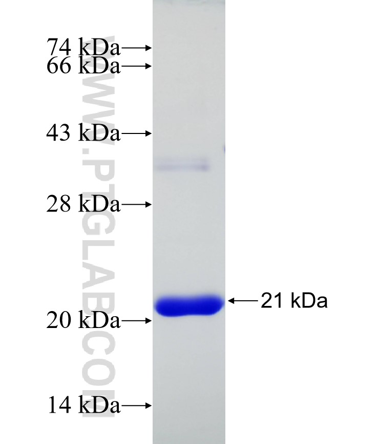 p504S,AMACR fusion protein Ag20778 SDS-PAGE p504S,AMACR fusion protein Ag20778 SDS-PAGE