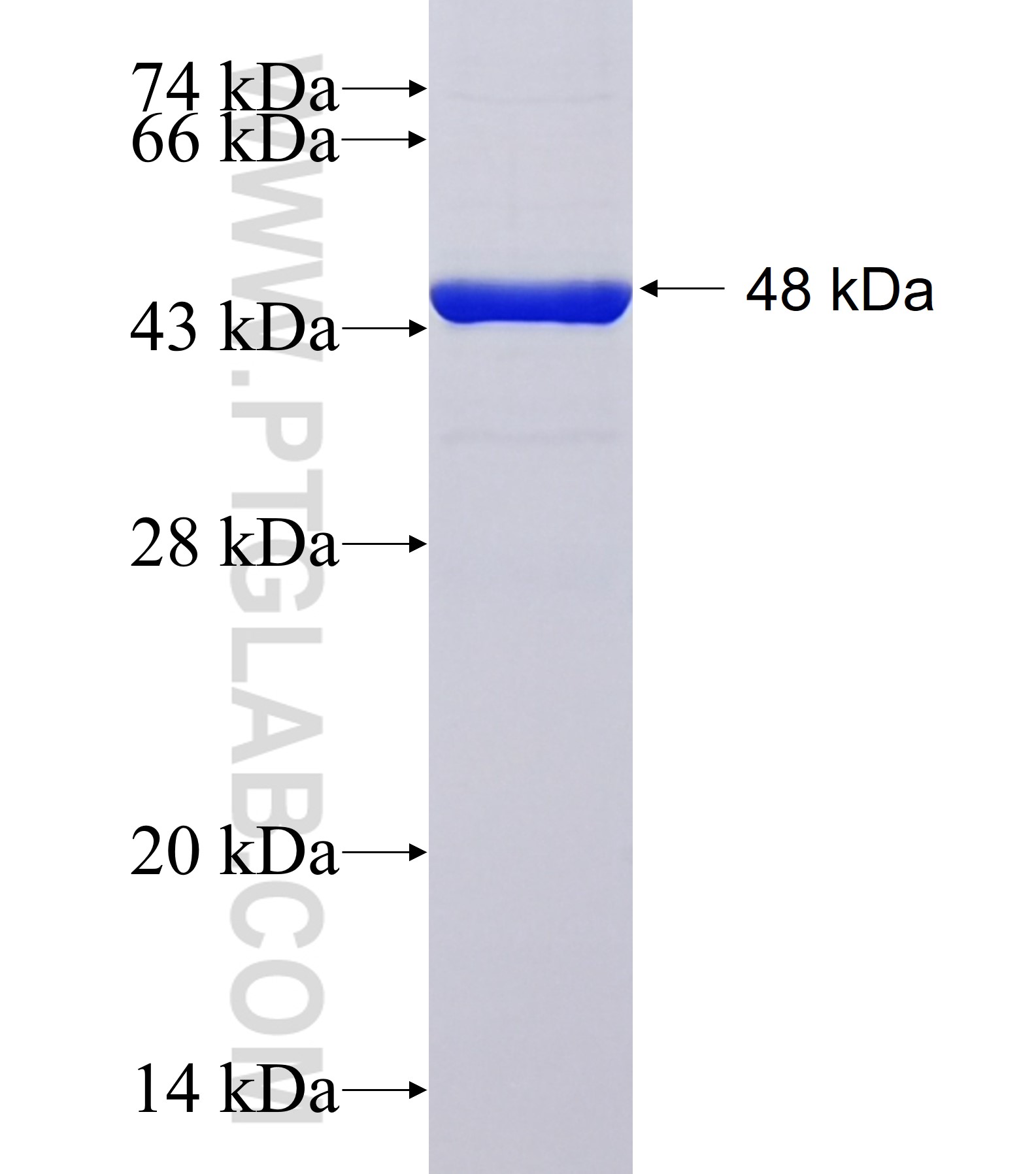 p53 fusion protein Ag41739 SDS-PAGE p53 fusion protein Ag41739 SDS-PAGE
