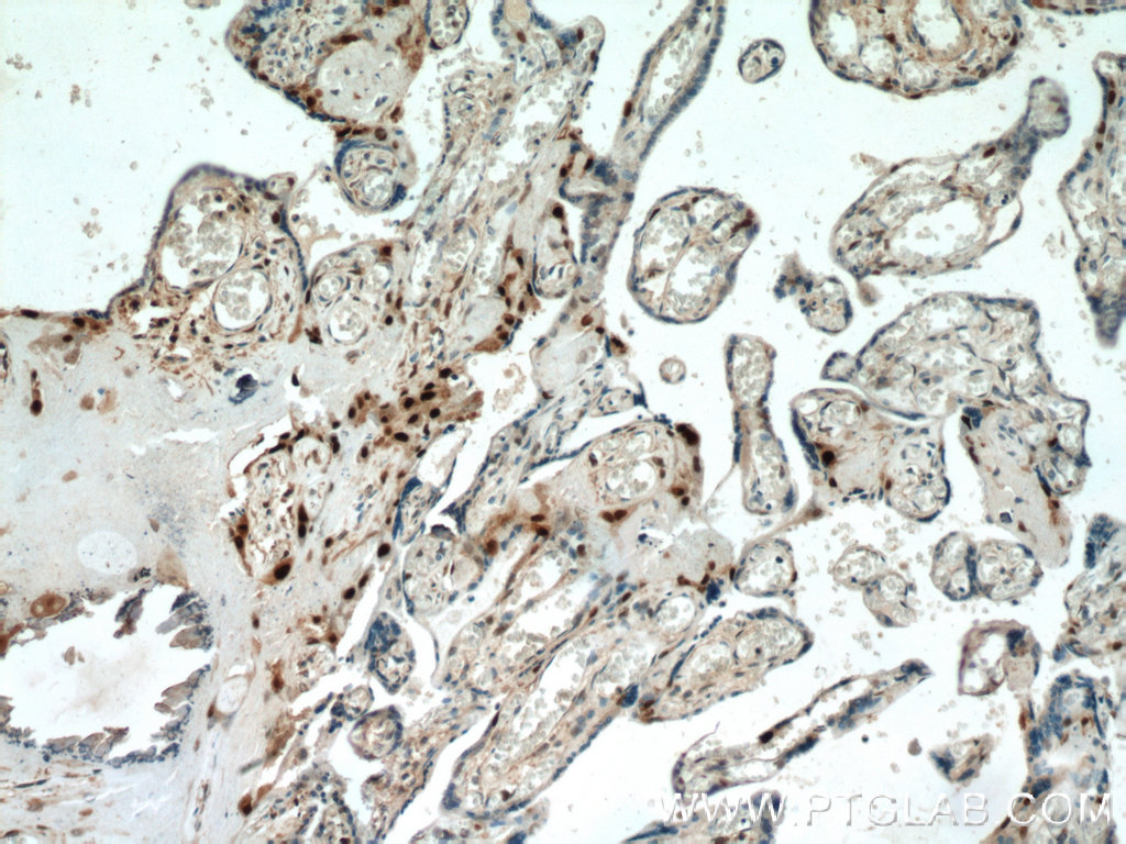 IHC staining of human placenta using 23317-1-AP