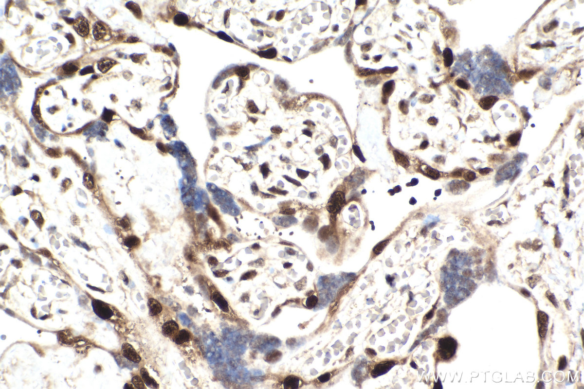IHC staining of human placenta using 66794-1-Ig