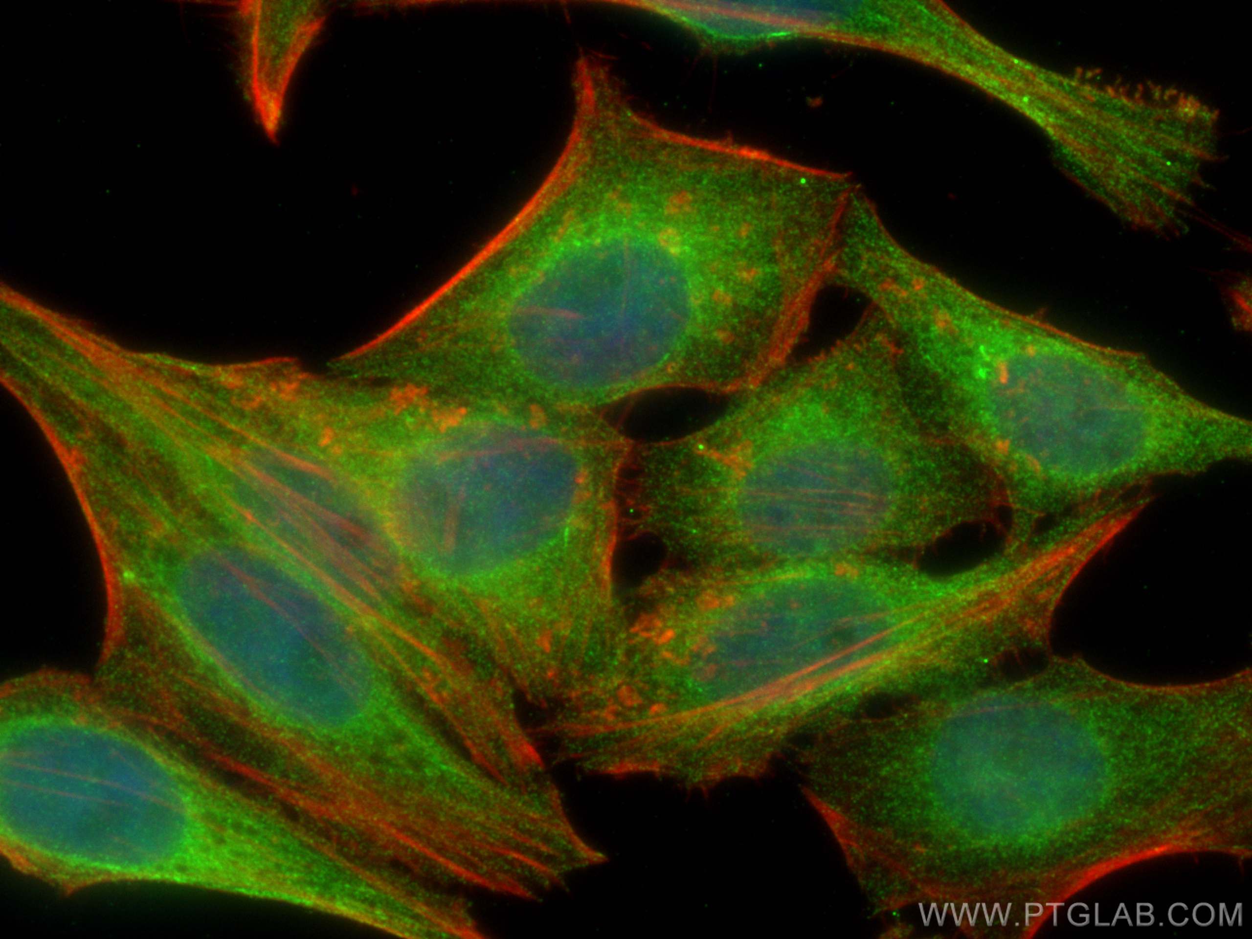 IF Staining of HepG2 using 66535-1-Ig